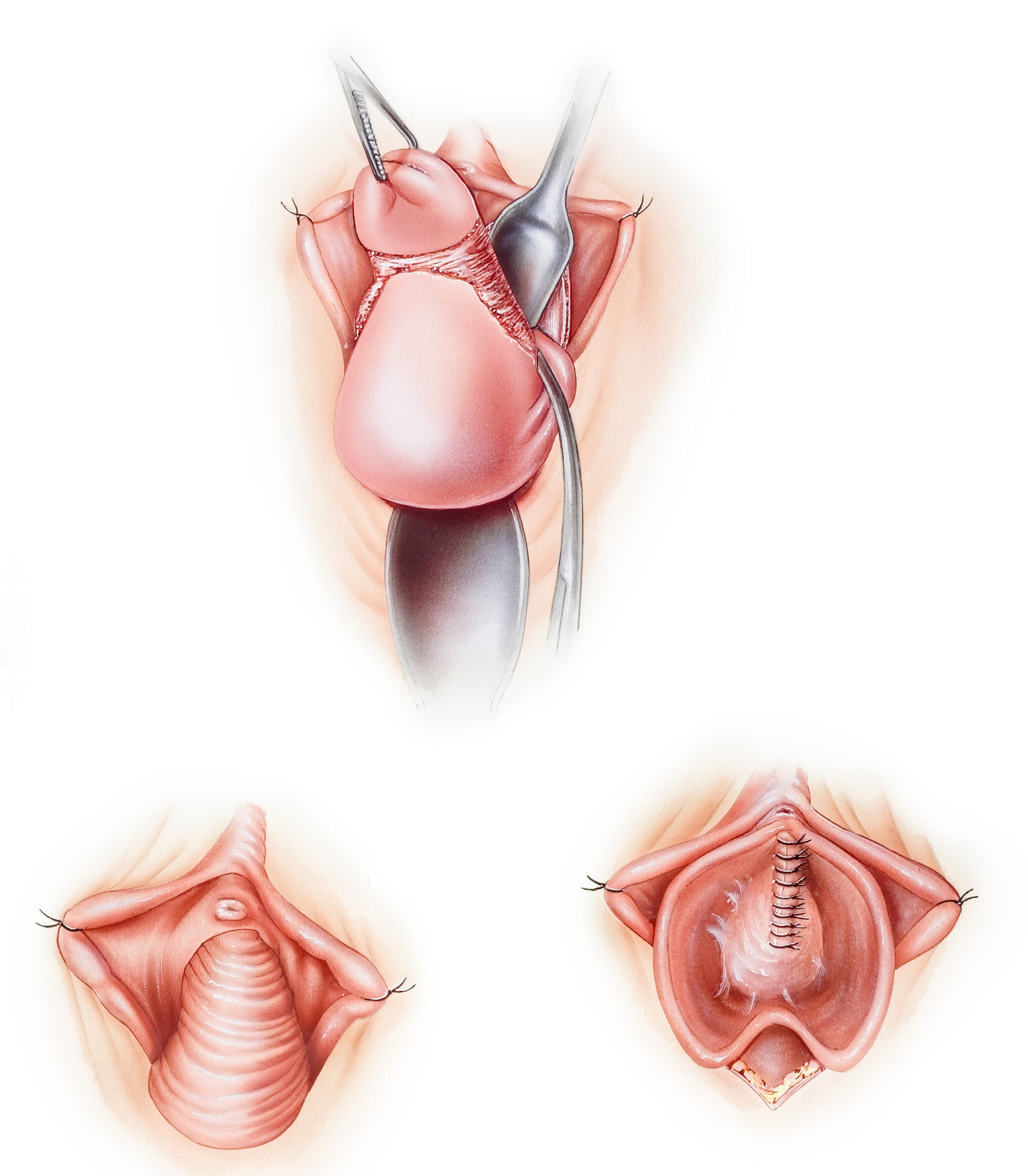 Szilvia Lauren Valeriy yozgi haqiqat Shohlar